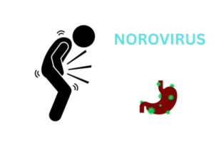 Illustration of Norovirus particles causing stomach flu