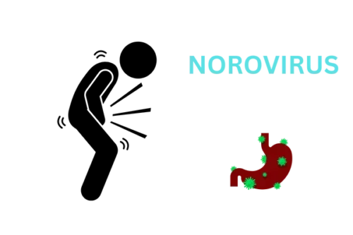 Illustration of Norovirus particles causing stomach flu